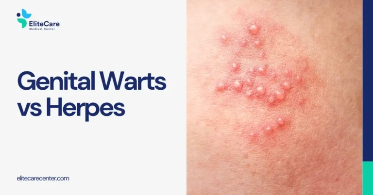 Difference Between Genital Warts and Herpes: What You Need to Know