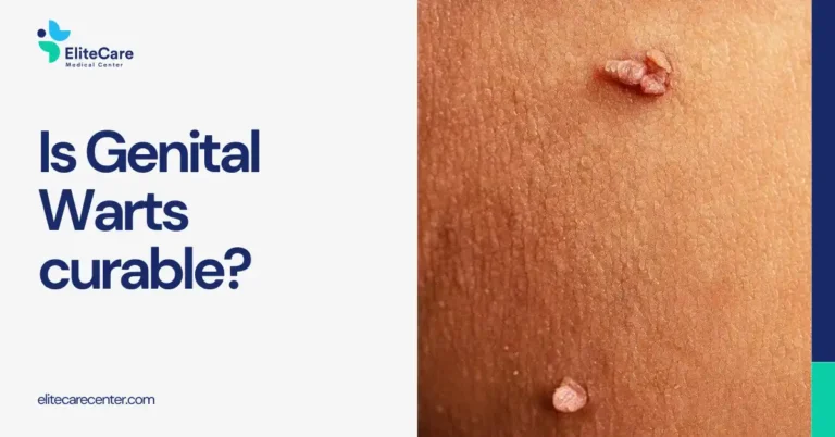 Is Genital Warts Curable?