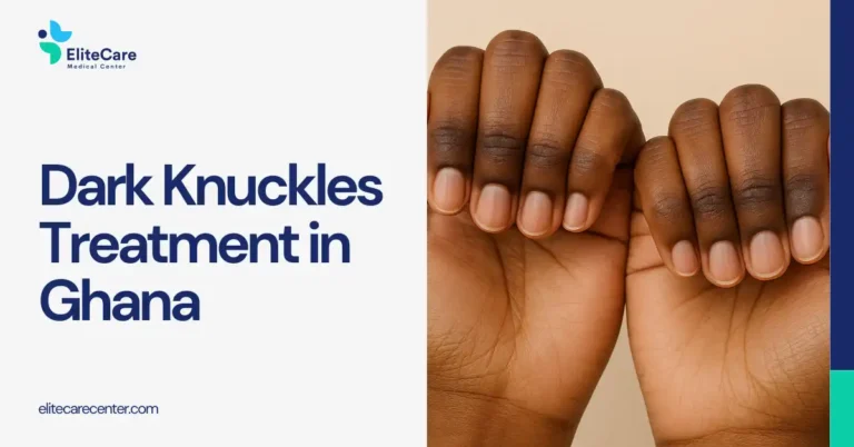 Dark Knuckles Treatment in Ghana: Causes, Mistakes, and What Actually Works