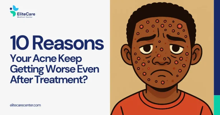 10 Reasons Your Acne Keep Getting Worse Even After Treatment