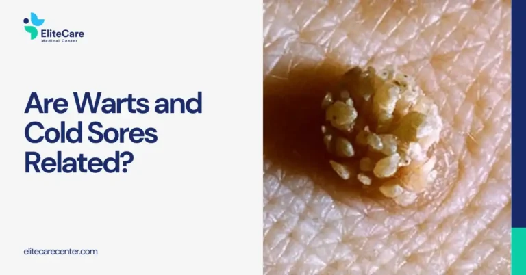 Are Warts and Cold Sores Related? Understanding the Real Difference