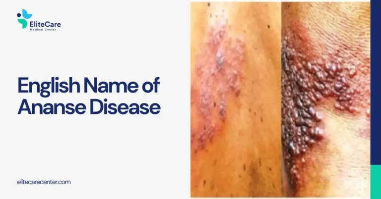 English Name for Ananse Disease (What It Really Means in Ghana)