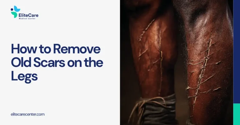 How to Remove Old Scars on the Legs