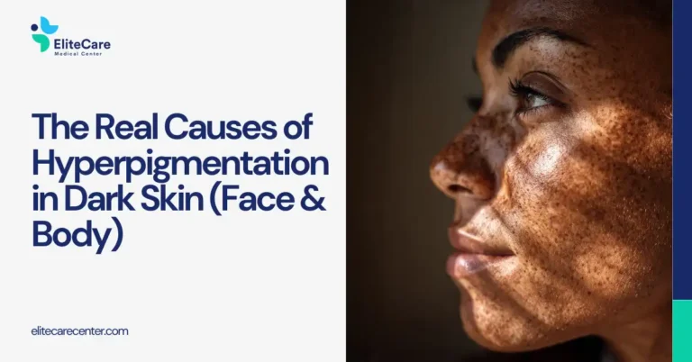 The Real Causes of Hyperpigmentation in Dark Skin (Face & Body)