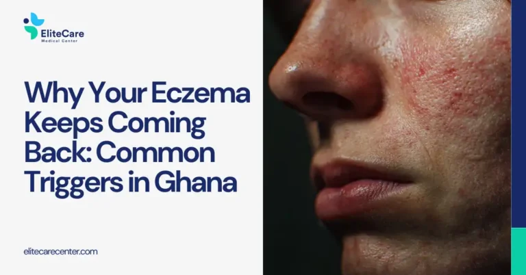 Why Your Eczema Keeps Coming Back: Common Triggers in Ghana