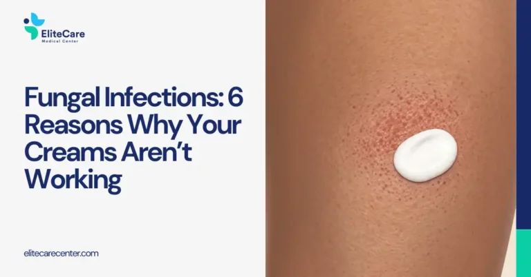Fungal Infections That Keep Returning: 6 Reasons Why Your Creams Aren’t Working